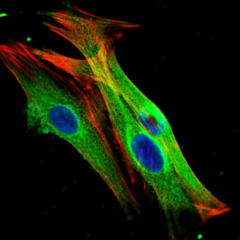 CBL Antibody