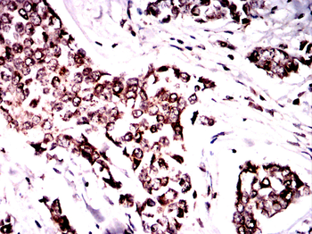 CBL Antibody