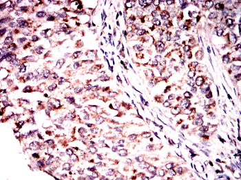 CBL Antibody
