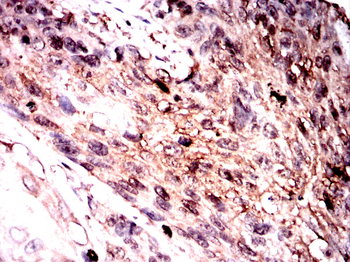 SFTPC Rabbit Polyclonal Antibody