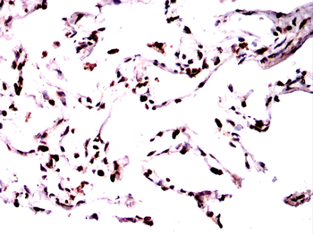 SFTPC Rabbit Polyclonal Antibody