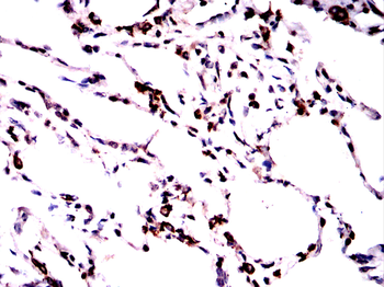 SFTPC Rabbit Polyclonal Antibody