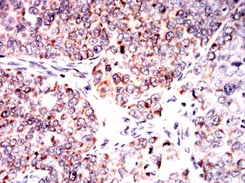 ABCC4 Antibody