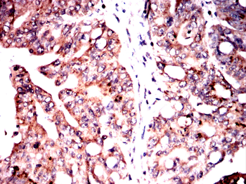 ABCC4 Antibody