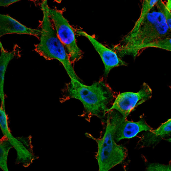 ABCC4 Antibody