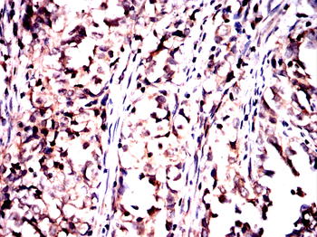 ABCC4 Antibody