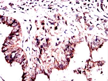 ABCC4 Antibody