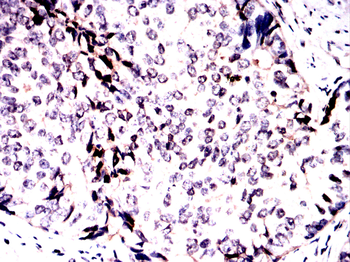 ABCC4 Antibody