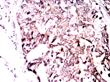 IGFBP7 Antibody