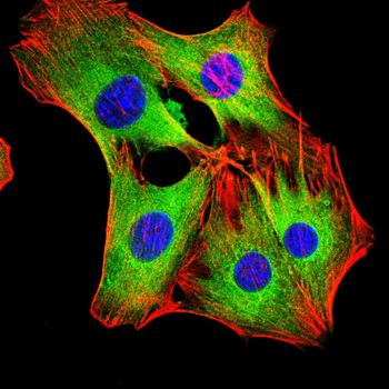 ITGA2B Antibody