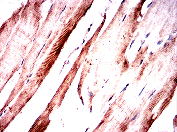 B2M Antibody