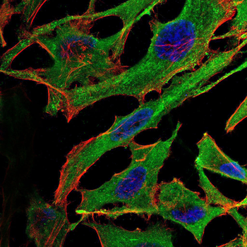 NPC1 Antibody