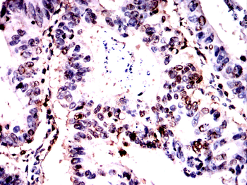 NBN Antibody