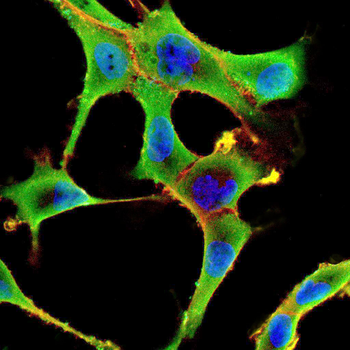 GCK Antibody