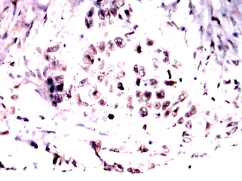 GCK Antibody