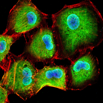 CLGN Rabbit Polyclonal Antibody