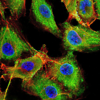 ABCG5 Rabbit Polyclonal Antibody