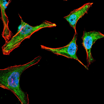 ABCG5 Rabbit Polyclonal Antibody