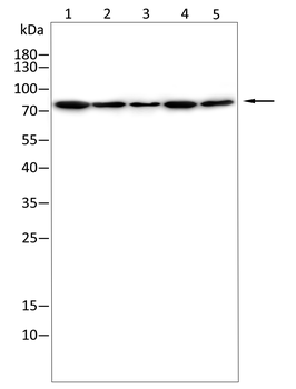 ABCG5 Rabbit Polyclonal Antibody