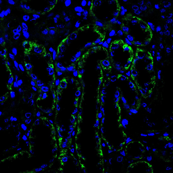 CDH16 Antibody