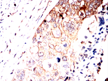 PRKCG Antibody