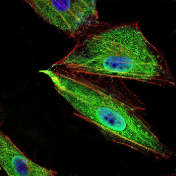 PPARGC1B Antibody