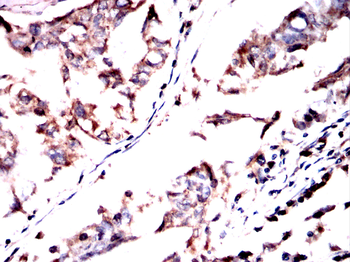 RANBP9 Antibody