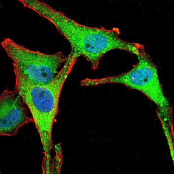 PDK2 Rabbit Polyclonal Antibody