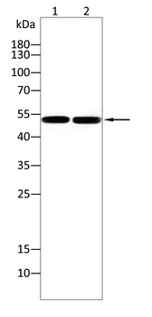 PDK2 Rabbit Polyclonal Antibody