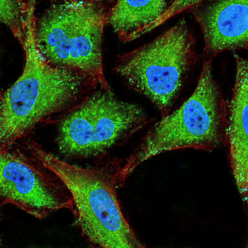PKN1 Antibody