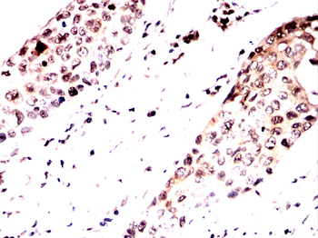 CSNK2B Antibody