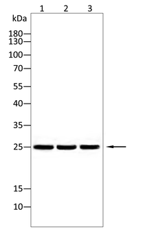 CSNK2B Antibody