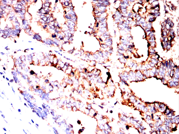 SEMA3A Antibody