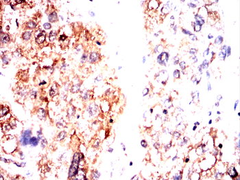 SEMA3A Antibody