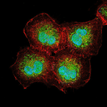 MEN1 Antibody