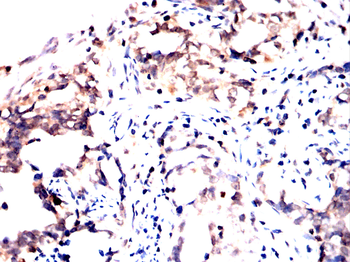 PRKACA Antibody