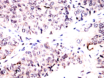 PRKACA Antibody