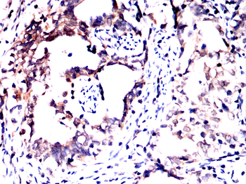 RANGAP1 Antibody