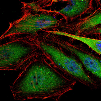 RANGAP1 Antibody