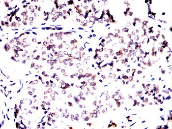 RANGAP1 Antibody
