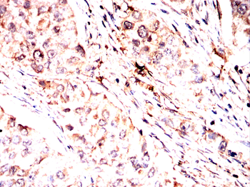RPS6KA2 Antibody