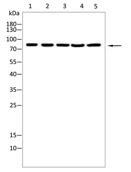 RPS6KA2 Antibody