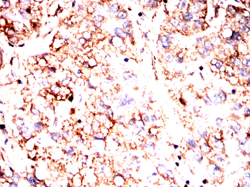 RPS6KA2 Antibody