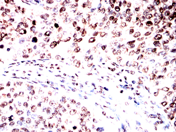 HSF1 Antibody