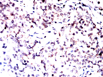 HSF1 Antibody