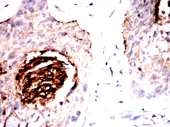 SERPINA3 Antibody
