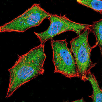 ADD1 Antibody