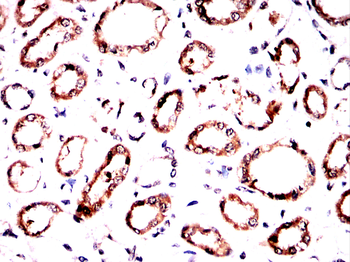 RAB8A Antibody