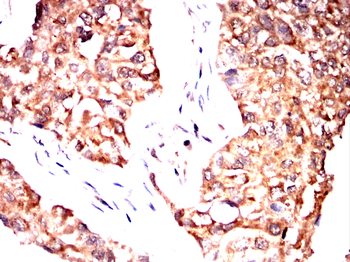 RAB8A Antibody