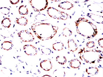 AKT Antibody
